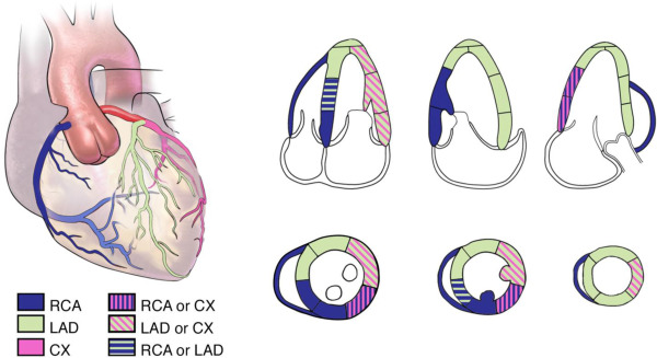 Chamber Quantification & Diseases of Heart