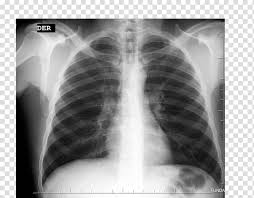 X-ray